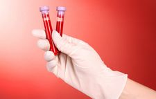 51% popusta na kompletnu laboratorijsku analizu krvi i urina